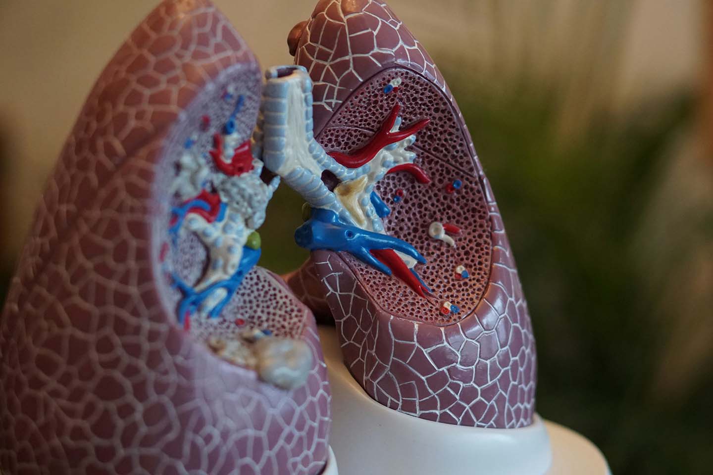 Model of human lungs showing internal anatomy